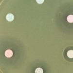 Antibiogrammes-sur-culture-Escherichia-coli-NICOLAS-Bertrand