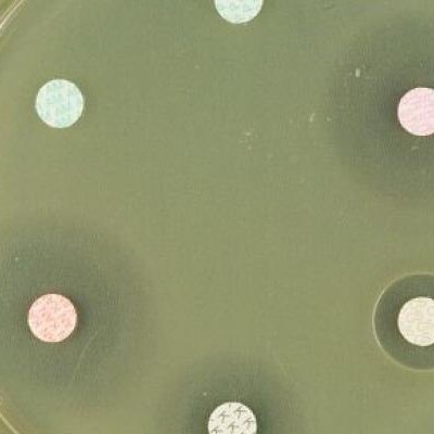Antibiogrammes-sur-culture-Escherichia-coli-NICOLAS-Bertrand © NICOLAS Bertrand / INRAE